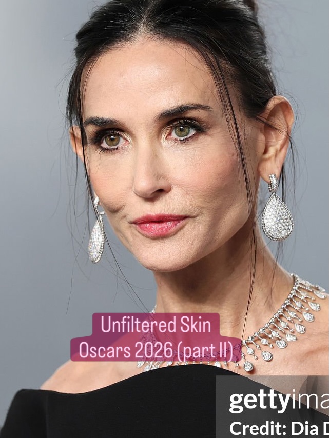 Ch&ugrave;m ảnh da thật đến mất l&ograve;ng của d&agrave;n sao Oscar 2026: Người nổi tiếng đang chuộng kiểu gi&agrave; đi một c&aacute;ch tự nhi&ecirc;n- Ảnh 8.