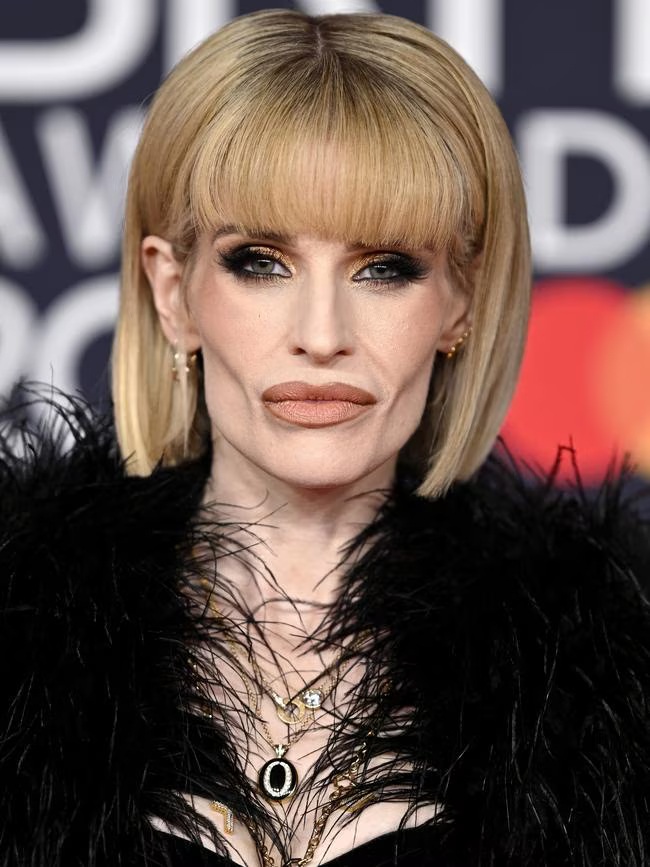 H&igrave;nh ảnh &aacute;i nữ showbiz hậu giảm 37kg g&acirc;y sốc, nhan sắc gi&agrave; đi 20 năm ph&aacute;t sợ- Ảnh 2.