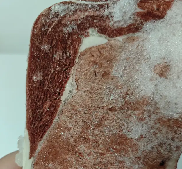 Thịt để tủ đ&aacute; tr&ocirc;ng như thế n&agrave;y tốt nhất n&ecirc;n vứt đi, cho trẻ con ăn c&agrave;ng nguy hiểm!- Ảnh 3.