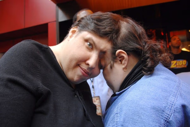 Cặp song sinh d&iacute;nh liền giấu nhau giới t&iacute;nh thật trong nhiều thập kỷ- Ảnh 3.