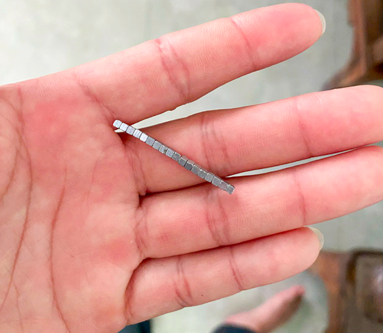 B&eacute; trai 5 tuổi nuốt h&agrave;ng chục vi&ecirc;n nam ch&acirc;m g&acirc;y thủng ruột- Ảnh 2.