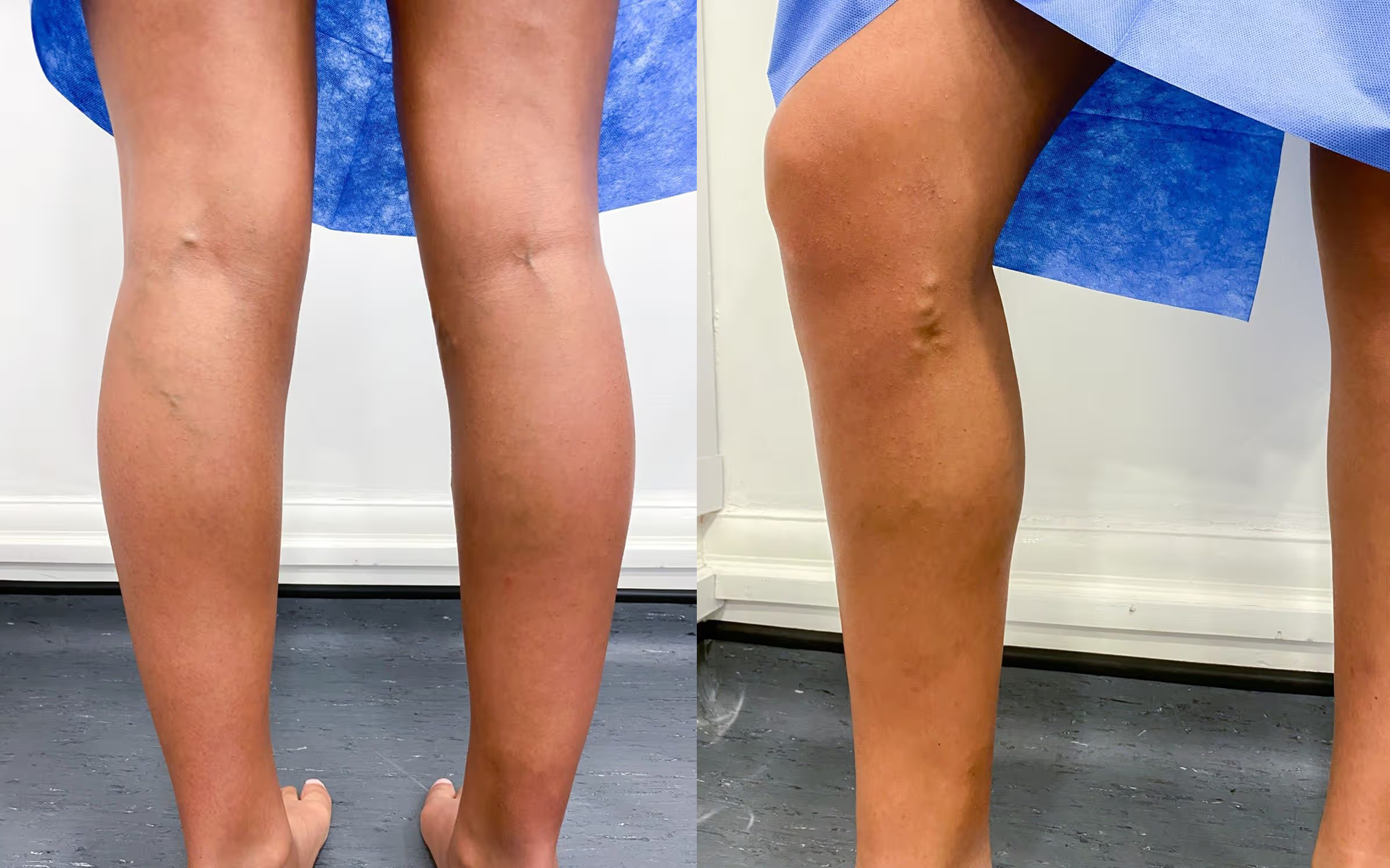 Nhờ bức ảnh "qu&aacute; xấu để đăng l&ecirc;n MXH", nữ diễn vi&ecirc;n 22 tuổi ph&aacute;t hiện ra căn bệnh nguy hiểm- Ảnh 3.