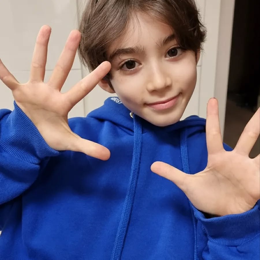 B&eacute; trai nổi tiếng to&agrave;n cầu v&igrave; đ&ocirc;i mắt đẹp như tranh vẽ giờ ra sao?- Ảnh 6.