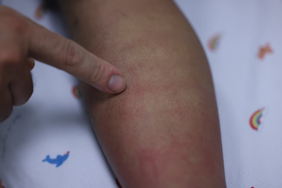 Sốt xuất huyết Dengue v&agrave; những dự định dở dang b&ecirc;n giường bệnh- Ảnh 2.