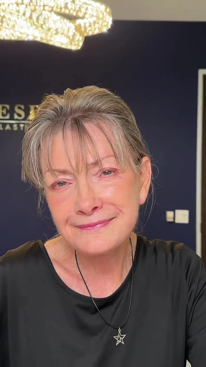 B&aacute;c sĩ thẩm mỹ được đặt lịch ồ ạt tới tận... 50 năm sau nhờ m&agrave;n cải l&atilde;o ho&agrave;n đồng th&agrave;nh c&ocirc;ng cho kh&aacute;ch h&agrave;ng- Ảnh 2.