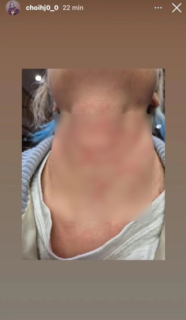 Nữ ca sĩ bị h&agrave;nh hung nghi&ecirc;m trọng, c&ograve;n bị &eacute;p viết thư xin lỗi- Ảnh 2.