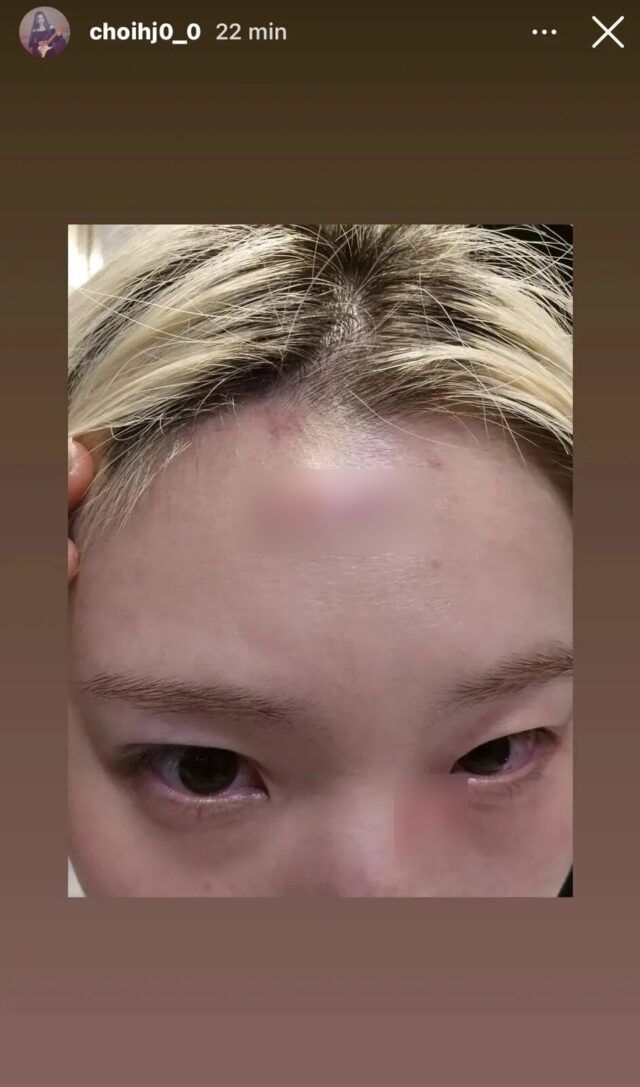 Nữ ca sĩ bị h&agrave;nh hung nghi&ecirc;m trọng, c&ograve;n bị &eacute;p viết thư xin lỗi- Ảnh 1.