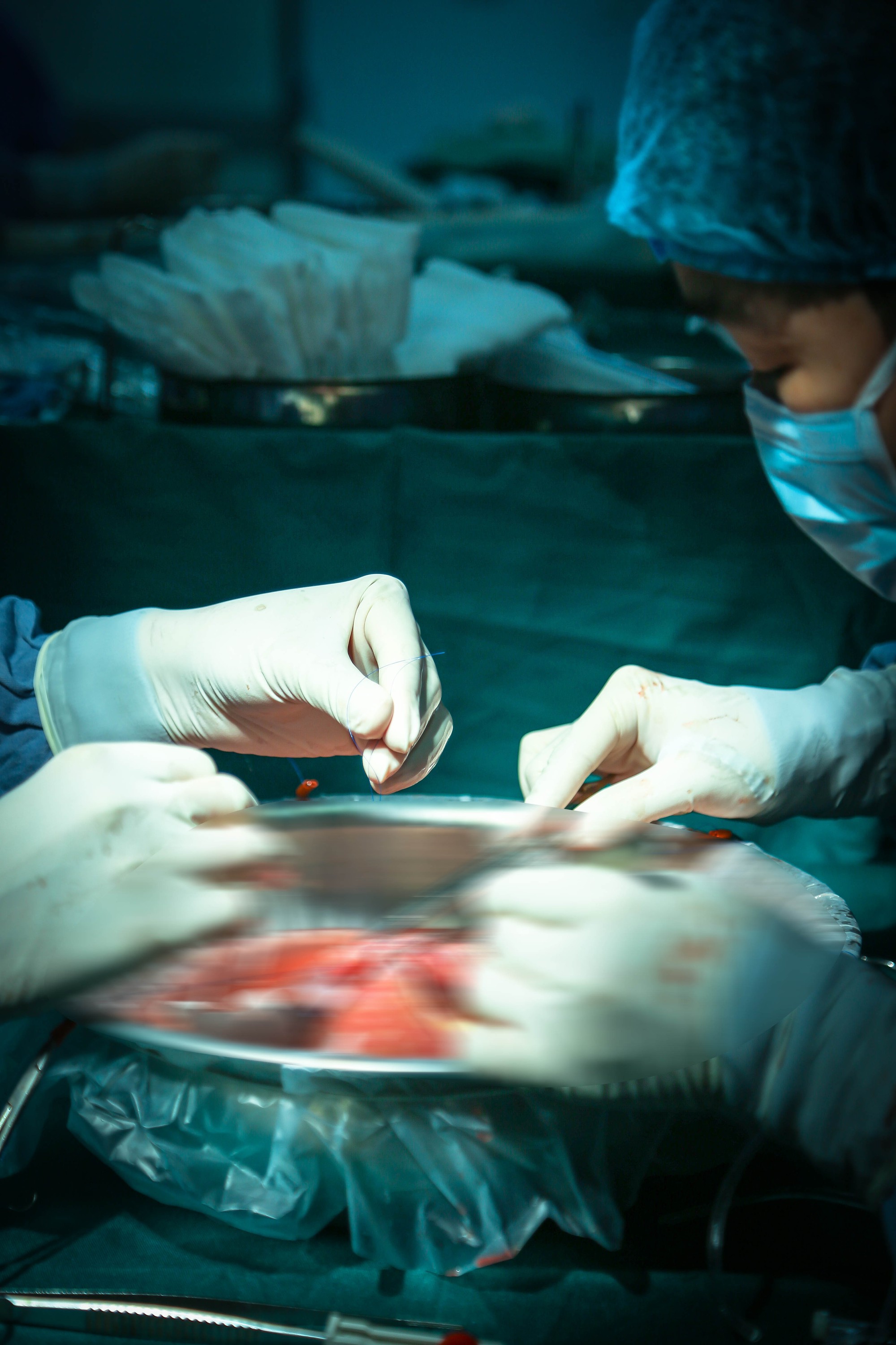 Ca ghép tạng domino đầu tiên tại Việt Nam: Hé lộ quy trình thực hiện và phân cảnh khiến nhiều người rơi nước mắt- Ảnh 6. Ca ghép tạng domino đầu tiên tại Việt Nam: Hé lộ quy trình thực hiện và phân cảnh khiến nhiều người rơi nước mắt- Ảnh 6.