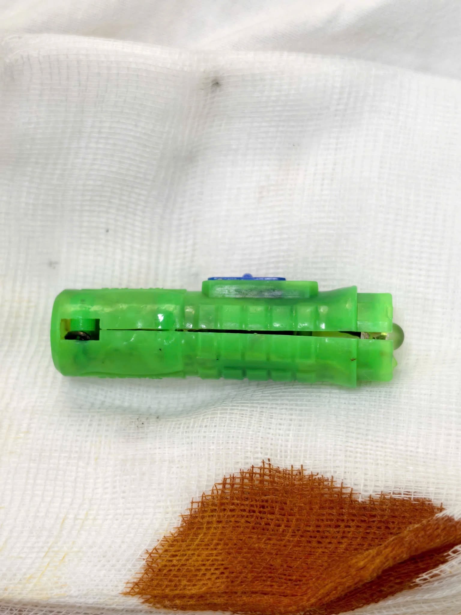 Bé 11 tuổi viêm âm đạo suốt 5 tháng, đến gặp bác sĩ Bệnh viện Phụ sản Hà Nội thì gắp được 1 vật hoen gỉ bên trong- Ảnh 1. Bé 11 tuổi viêm âm đạo suốt 5 tháng, đến gặp bác sĩ Bệnh viện Phụ sản Hà Nội thì gắp được 1 vật hoen gỉ bên trong- Ảnh 1.