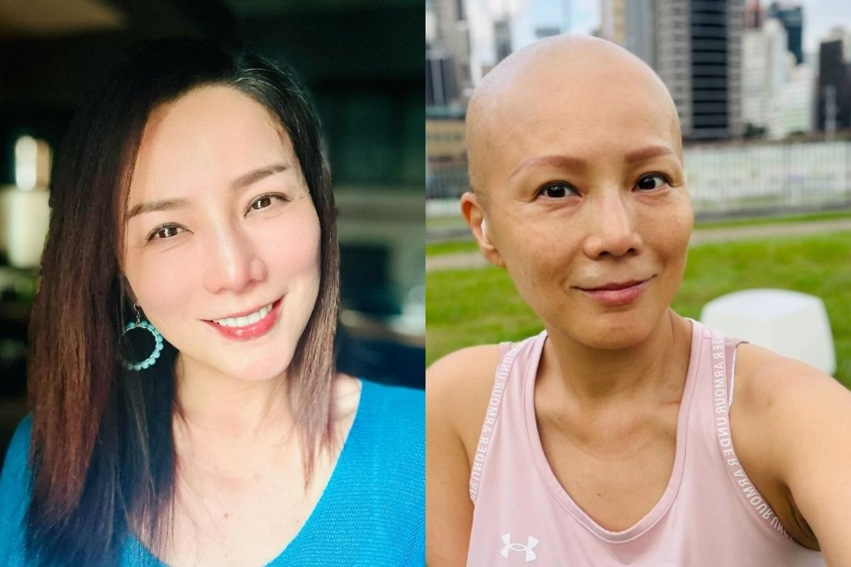 &Aacute; hậu Hong Kong suy sụp v&igrave; ung thư- Ảnh 1.