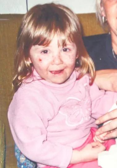 Bi kịch "c&ocirc; b&eacute; ma c&agrave; rồng" đời thực- Ảnh 2.