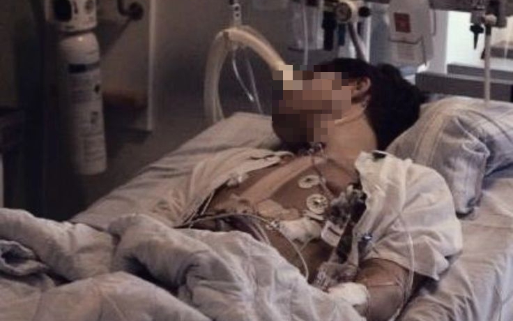 Nam sinh 18 tuổi tử vong v&igrave; ung thư đại trực tr&agrave;ng, b&aacute;c sĩ: 