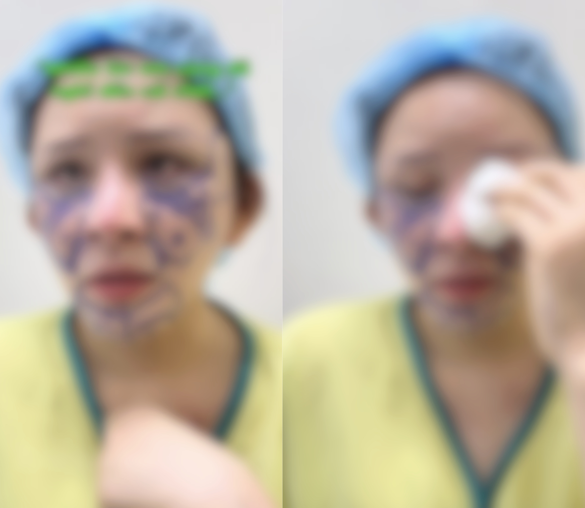 X&ocirc;n xao vụ c&ocirc; g&aacute;i h&uacute;t mỡ hết 70 triệu nhận lại mặt biến dạng, nửa đ&ecirc;m "phốt" b&aacute;c sĩ thẩm mỹ: Ph&iacute;a b&aacute;c sĩ n&oacute;i g&igrave;?- Ảnh 2.