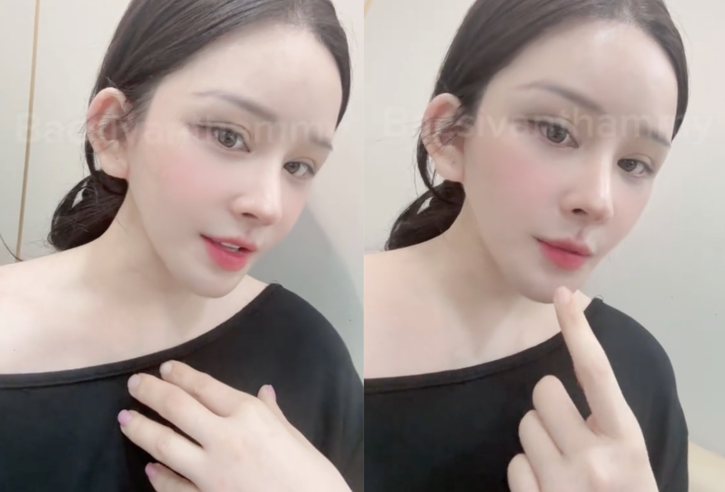 X&ocirc;n xao vụ c&ocirc; g&aacute;i h&uacute;t mỡ hết 70 triệu nhận lại mặt biến dạng, nửa đ&ecirc;m "phốt" b&aacute;c sĩ thẩm mỹ: Ph&iacute;a b&aacute;c sĩ n&oacute;i g&igrave;?- Ảnh 4.