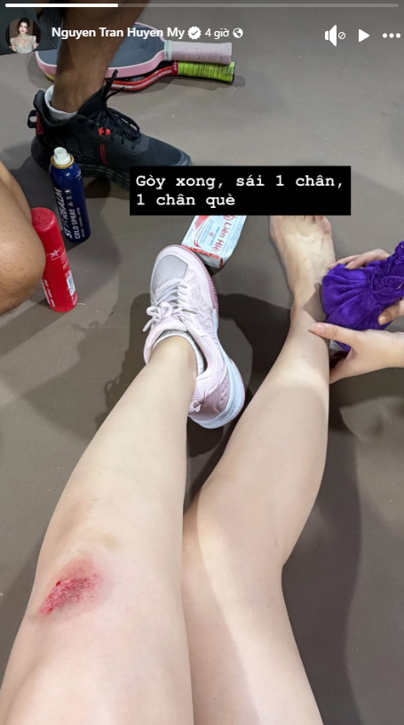 &Aacute; hậu Huyền My gặp tai nạn khi chơi pickleball- Ảnh 1.