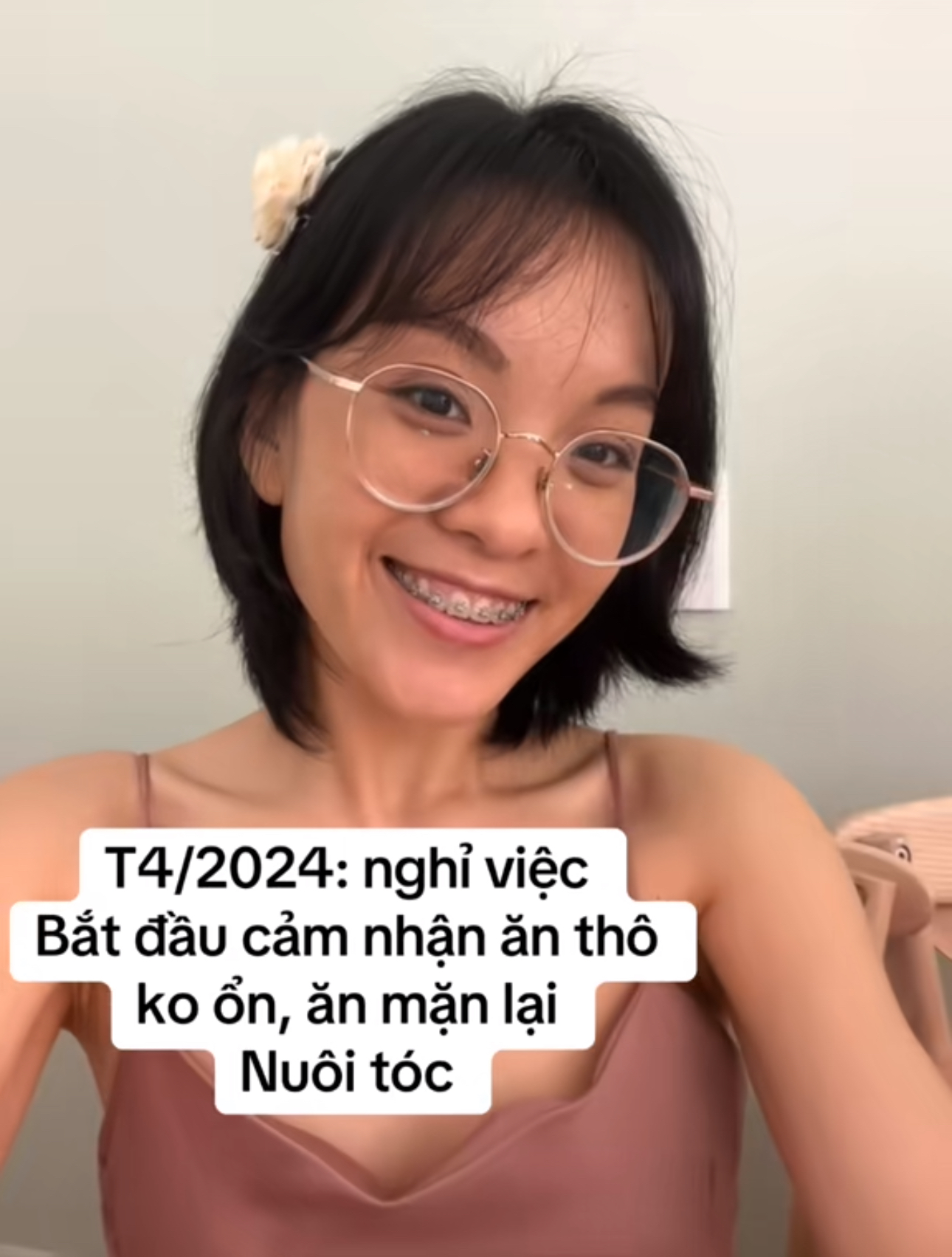 M&agrave;n thay đổi "đ&aacute;ng đồng tiền" của c&ocirc; g&aacute;i TP.HCM sau khi từ bỏ ăn th&ocirc;, niềng răng v&agrave; mổ mắt cận- Ảnh 5.