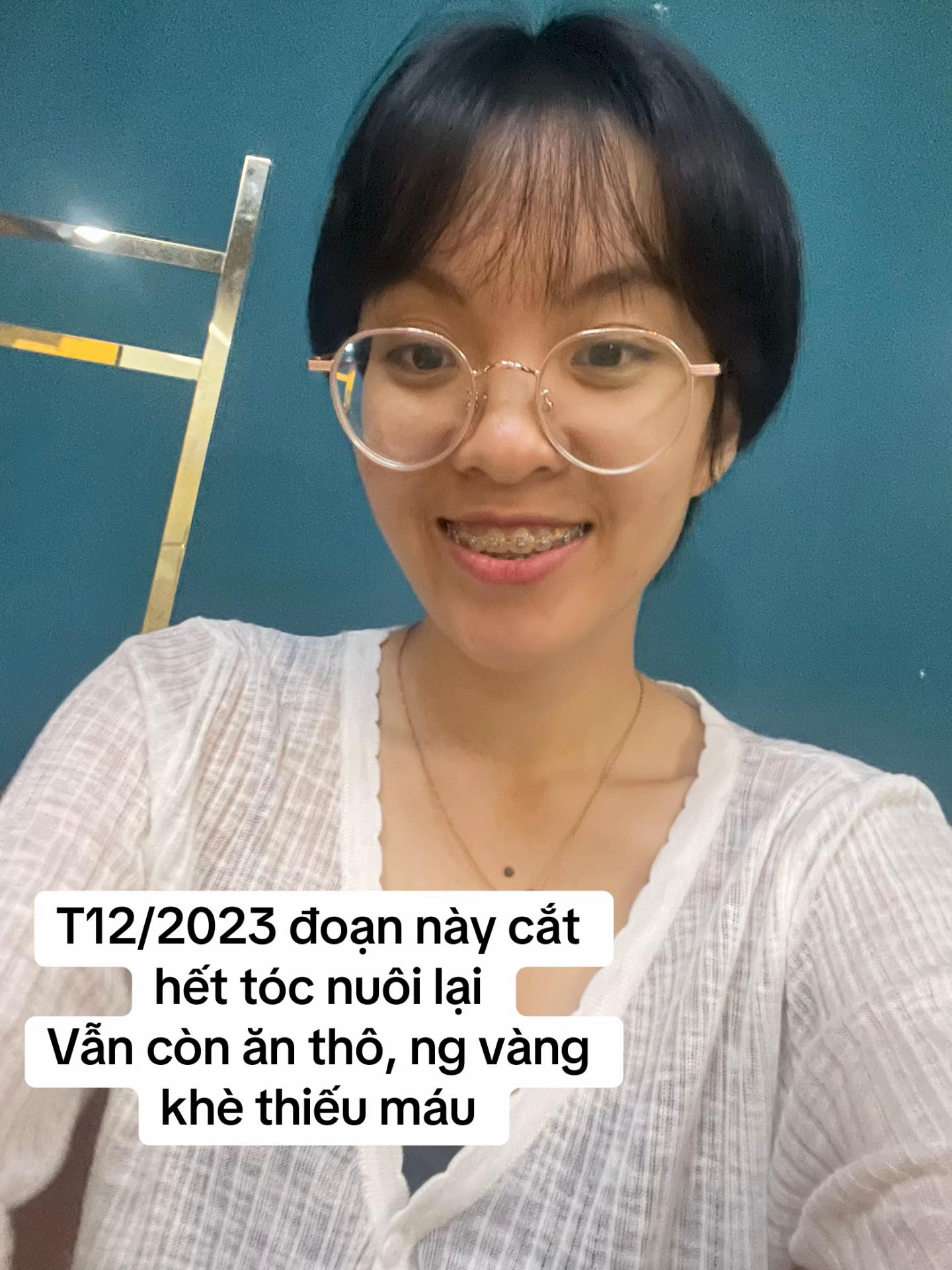 M&agrave;n thay đổi "đ&aacute;ng đồng tiền" của c&ocirc; g&aacute;i TP.HCM sau khi từ bỏ ăn th&ocirc;, niềng răng v&agrave; mổ mắt cận- Ảnh 2.