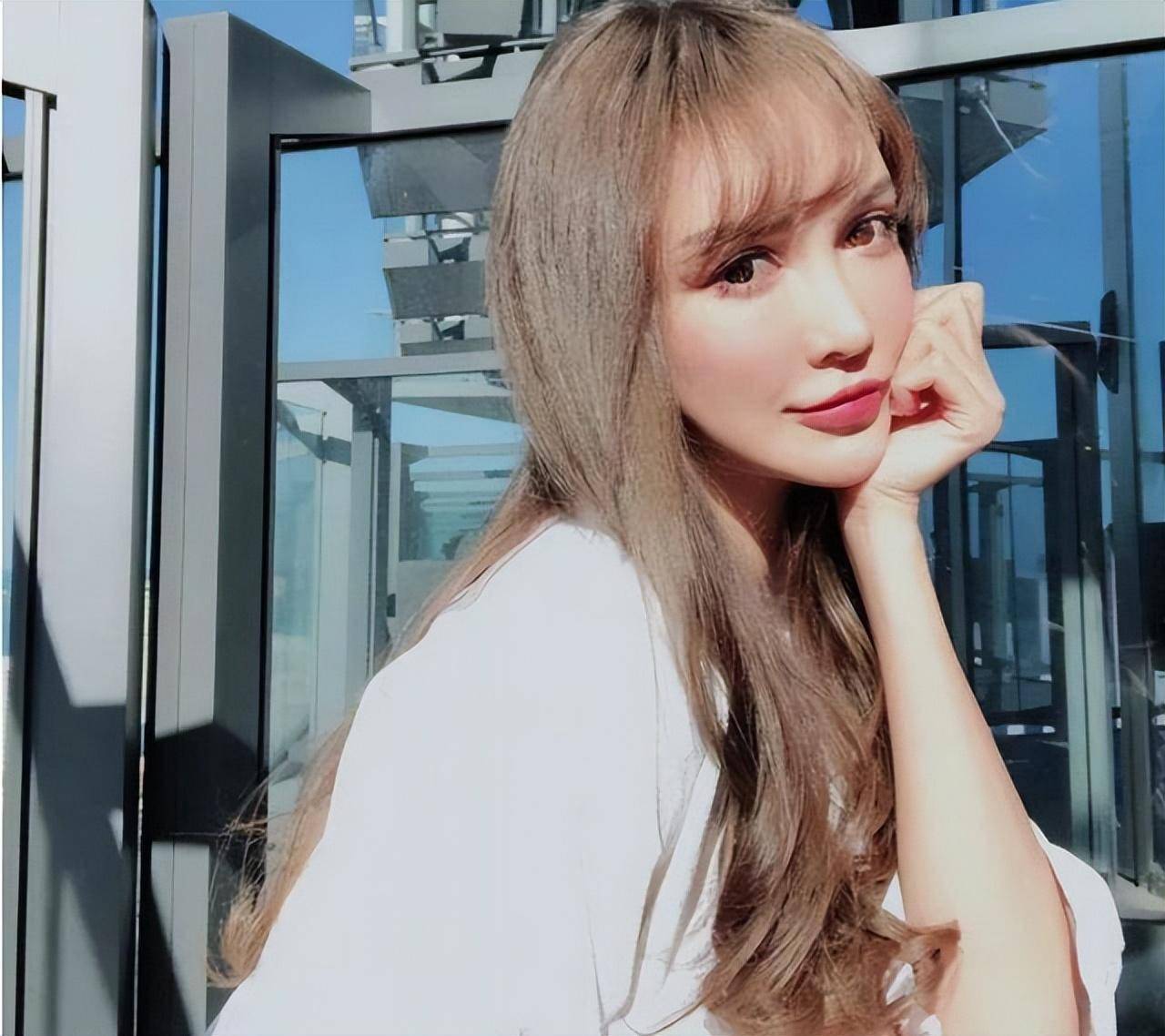 C&ocirc; g&aacute;i cao 1m80 bị &eacute;p dao k&eacute;o từ năm 14 tuổi, hơn 300 lần phẫu thuật: Gương mặt hiện tại thế n&agrave;o?- Ảnh 7.