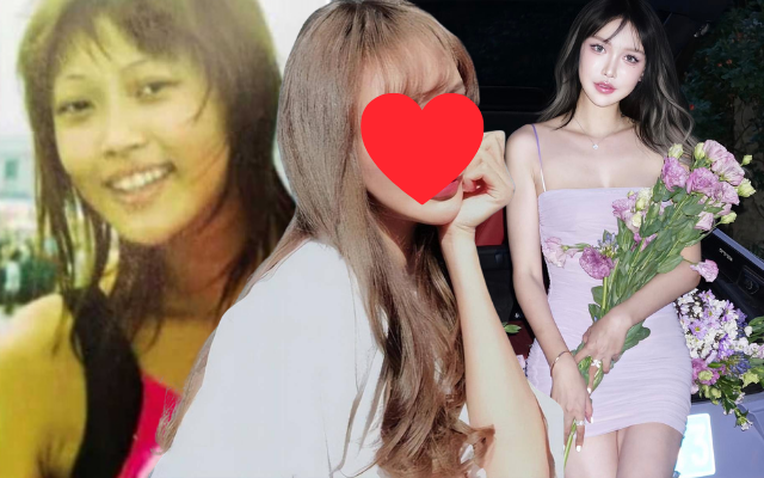 C&ocirc; g&aacute;i cao 1m80 bị &eacute;p dao k&eacute;o từ năm 14 tuổi, hơn 300 lần phẫu thuật: Gương mặt hiện tại thế n&agrave;o?- Ảnh 1.