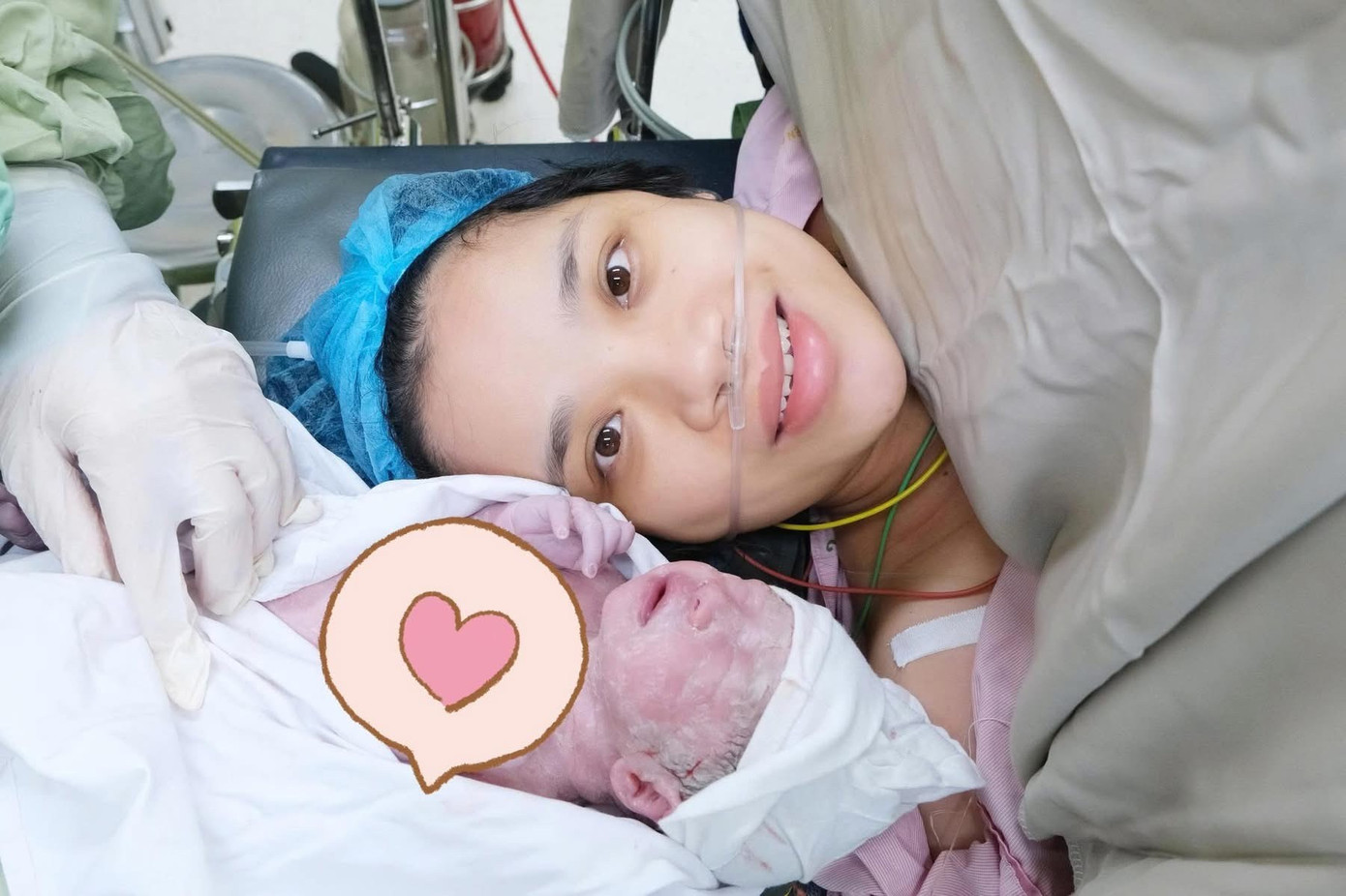 7 lần sảy thai, lần thứ 8 sinh con: K&igrave; t&iacute;ch từ ca song thai kh&ocirc;ng tim- Ảnh 2.