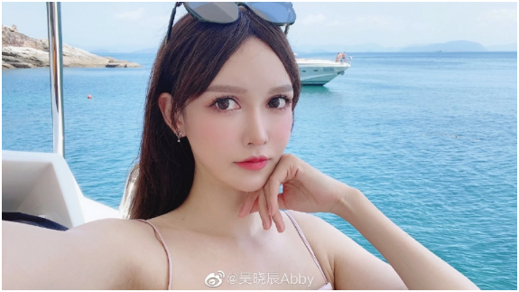 C&ocirc; g&aacute;i cao 1m80 bị &eacute;p dao k&eacute;o từ năm 14 tuổi, hơn 300 lần phẫu thuật: Gương mặt hiện tại thế n&agrave;o?- Ảnh 2.