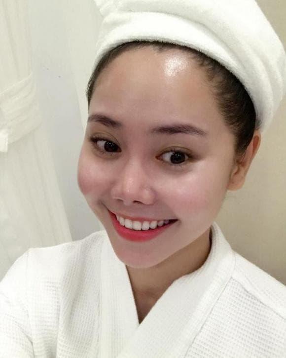 Bức ảnh chụp cận sau ca can thiệp 