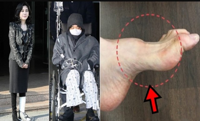 Gia tộc Samsung v&agrave; căn bệnh di truyền đ&aacute;ng sợ mang t&ecirc;n teo cơ M&Aacute;C: C&oacute; tất cả nhưng cũng kh&ocirc;ng thể chữa khỏi- Ảnh 5.