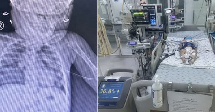 B&eacute; g&aacute;i mới biết đi bị ng&atilde; v&agrave;o th&ugrave;ng nước khiến ngưng tim ngưng thở- Ảnh 1.