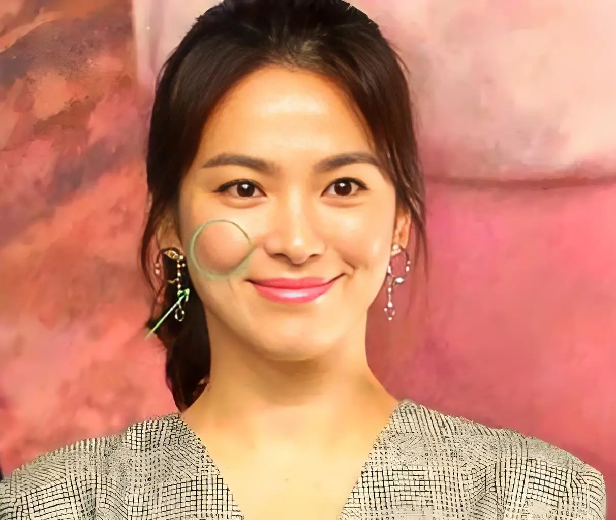 Tr&aacute;nh sai lầm khi chống l&atilde;o h&oacute;a v&ugrave;ng &ldquo;m&aacute; hồng&ldquo;: Đừng vội ti&ecirc;m chất l&agrave;m đầy, h&atilde;y l&agrave;m việc n&agrave;y trước để trẻ lại- Ảnh 3.