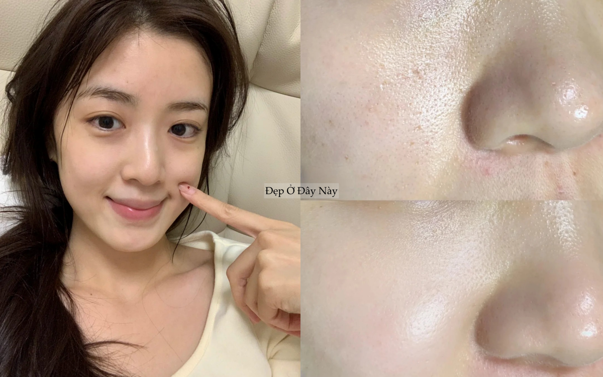 5 serum ngừa l&atilde;o h&oacute;a "made in Vietnam" gi&uacute;p ngừa l&atilde;o h&oacute;a hiệu quả- Ảnh 1.