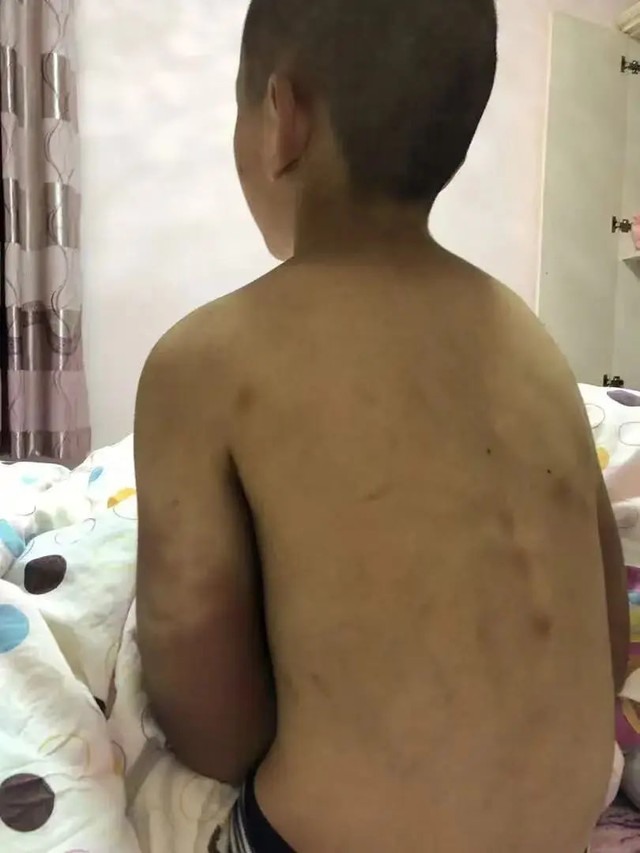 Bi kịch của cậu b&eacute; 14 tuổi vẫn phải mặc t&atilde;- Ảnh 4.