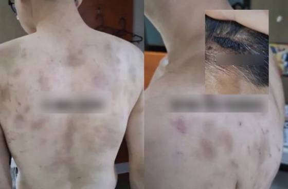 R&uacute;ng động H&agrave;n Quốc: Nam nh&acirc;n vi&ecirc;n bị chủ qu&aacute;n h&agrave;nh hạ, &eacute;p l&agrave;m việc 20 giờ/ng&agrave;y, camera gi&aacute;m s&aacute;t 24/7- Ảnh 1.