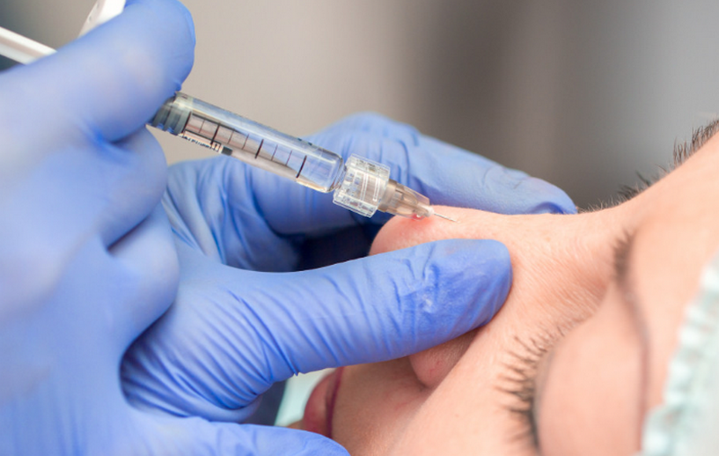 C&ocirc; g&aacute;i ở TP.HCM gặp biến chứng sau mũi ti&ecirc;m 27 triệu tại nh&agrave;, người thực hiện "mất t&iacute;ch b&iacute; ẩn" khiến ai cũng r&ugrave;ng m&igrave;nh- Ảnh 1.