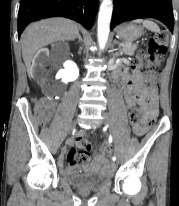 Nhiều người Việt phải cắt bỏ thận chỉ vì tự ý dùng 1 thứ tưởng là "lành tính": Cảnh báo từ bác sĩ- Ảnh 1. Nhiều người Việt phải cắt bỏ thận chỉ vì tự ý dùng 1 thứ tưởng là "lành tính": Cảnh báo từ bác sĩ- Ảnh 1.