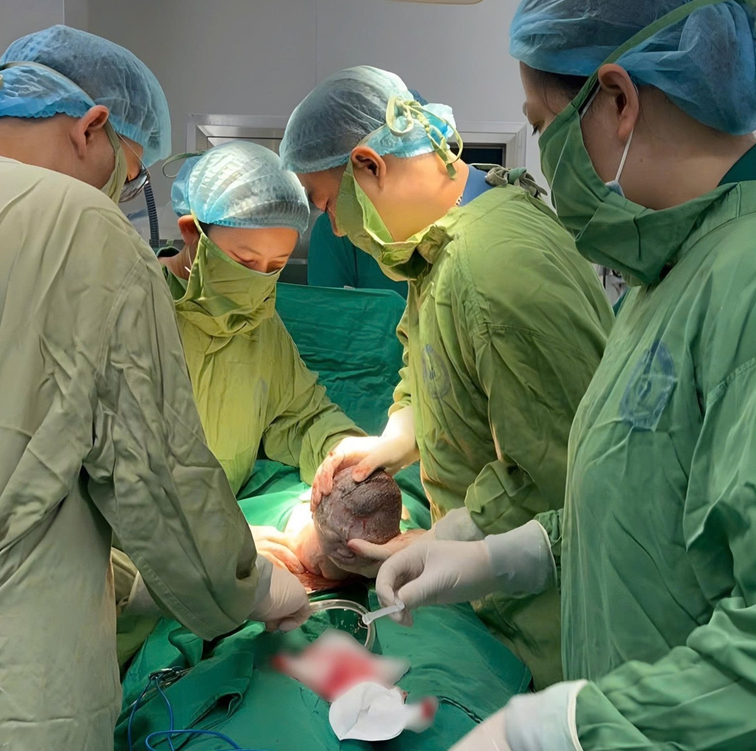 Em b&eacute; sinh ra với "đ&ocirc;i c&aacute;nh nhỏ" tr&ecirc;n lưng: Mẹ ơi! Con đến với mẹ rồi đ&acirc;y!- Ảnh 1.