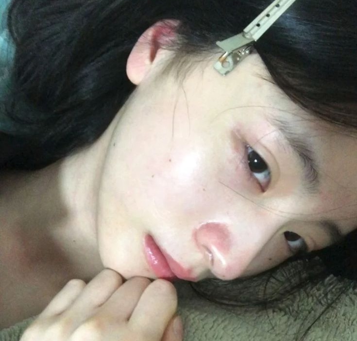 Nếp nhăn rất "kỵ" 4 thực phẩm n&agrave;y!- Ảnh 1.