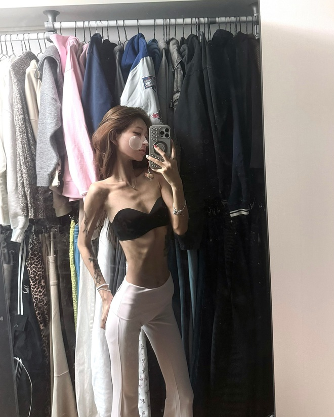 Con g&aacute;i Choi Jil Sil c&oacute; đang h&agrave;nh hạ bản th&acirc;n: Th&acirc;n h&igrave;nh da bọc xương, nghiện thẩm mỹ, khao kh&aacute;t 1 thứ giống Jennie- Ảnh 3.