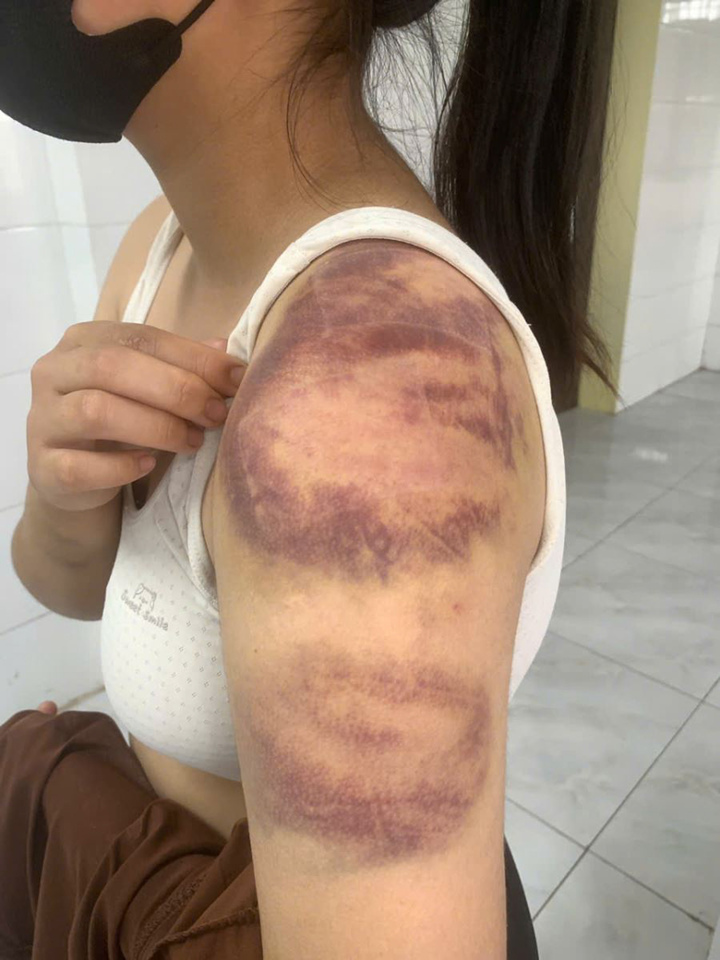 Bắt người đ&agrave;n &ocirc;ng bạo h&agrave;nh vợ đang mang thai v&agrave; con 13 tuổi ở Bắc Ninh- Ảnh 2.