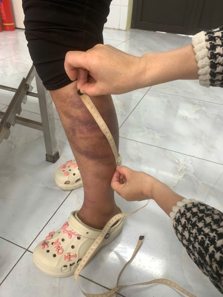 Bắt người đ&agrave;n &ocirc;ng bạo h&agrave;nh vợ đang mang thai v&agrave; con 13 tuổi ở Bắc Ninh- Ảnh 3.