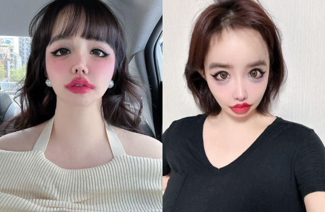 T&igrave;nh trạng đ&aacute;ng lo ngại của Park Bom sau khi viết t&acirc;m thư g&acirc;y sốc 