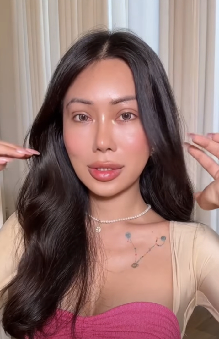 Mỹ nh&acirc;n chuyển giới An Giang kh&oacute;c l&oacute;c suy sụp sau khi ti&ecirc;m mỡ to&agrave;n mặt- Ảnh 6.