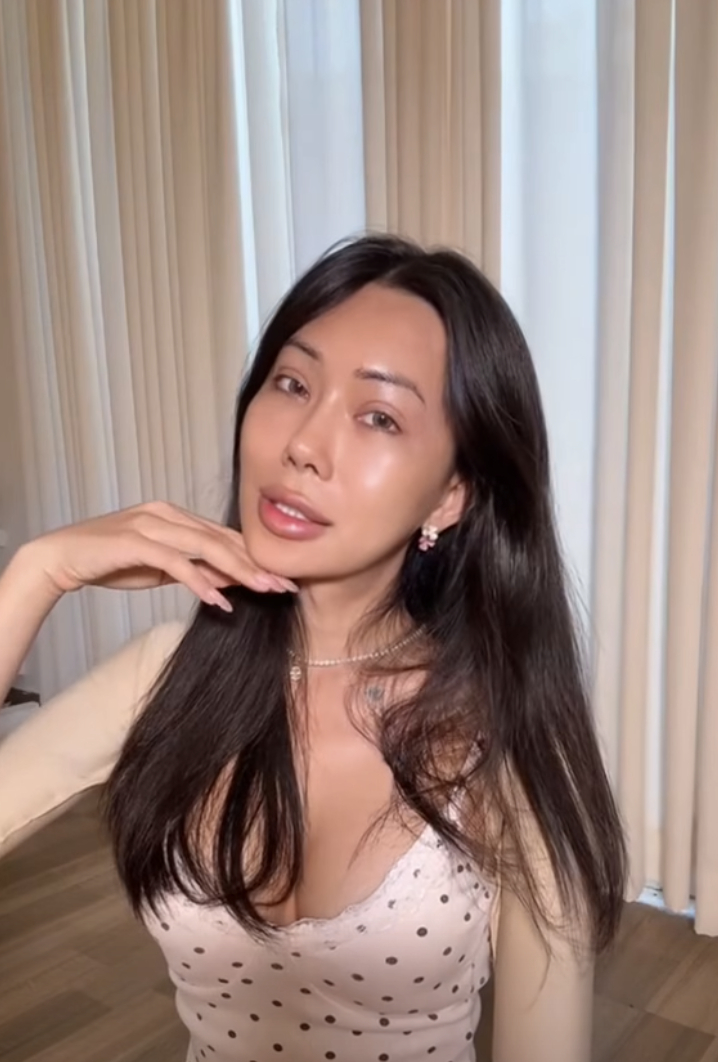 Mỹ nh&acirc;n chuyển giới An Giang kh&oacute;c l&oacute;c suy sụp sau khi ti&ecirc;m mỡ to&agrave;n mặt- Ảnh 5.