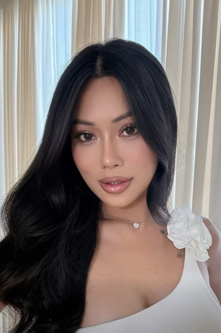 Mỹ nh&acirc;n chuyển giới An Giang kh&oacute;c l&oacute;c suy sụp sau khi ti&ecirc;m mỡ to&agrave;n mặt- Ảnh 7.