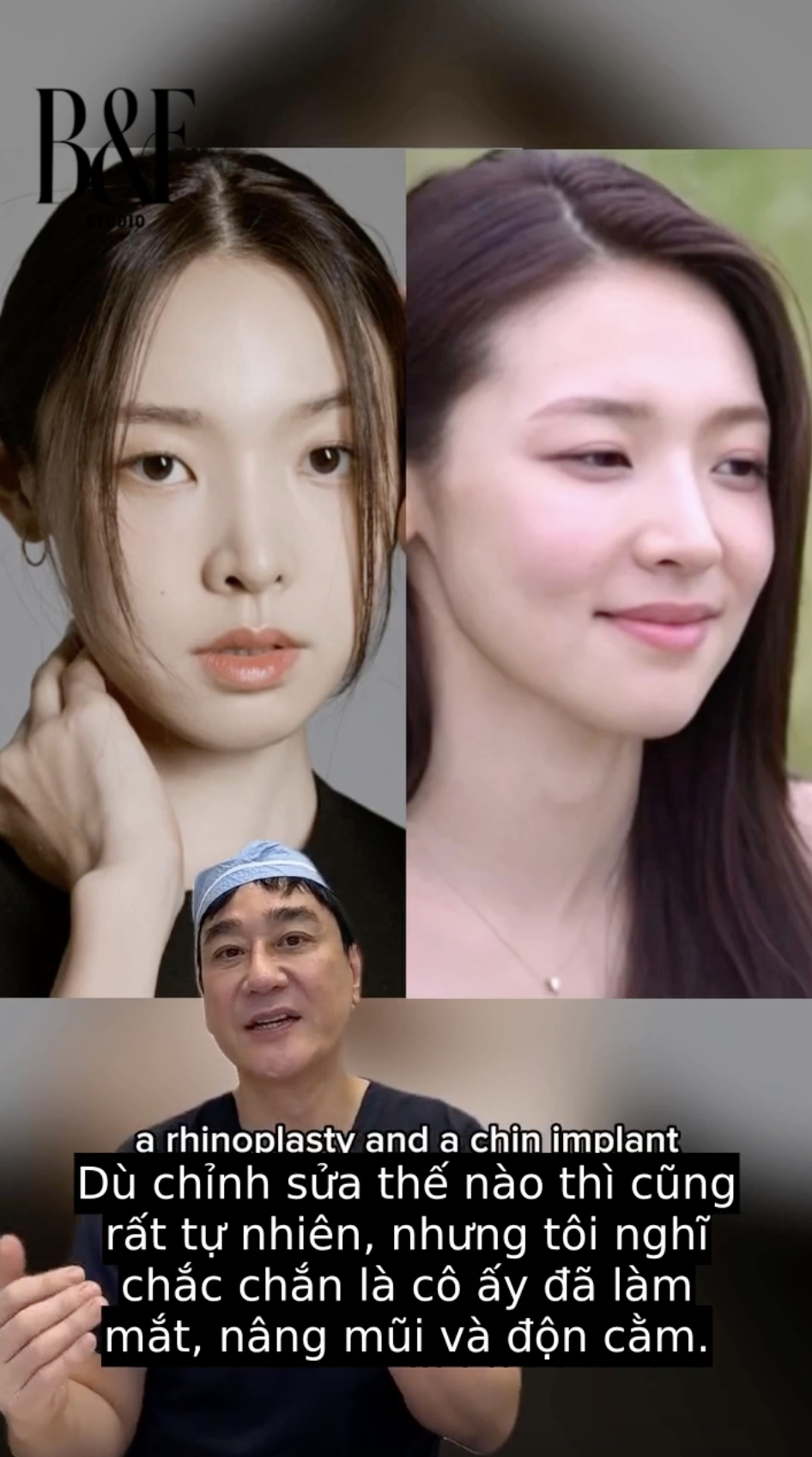 G&aacute;i xinh hot nhất show hẹn h&ograve; l&ecirc;n tiếng sau m&agrave;n phanh phui "n&aacute;t mặt" cả d&agrave;n mỹ nữ- Ảnh 9.