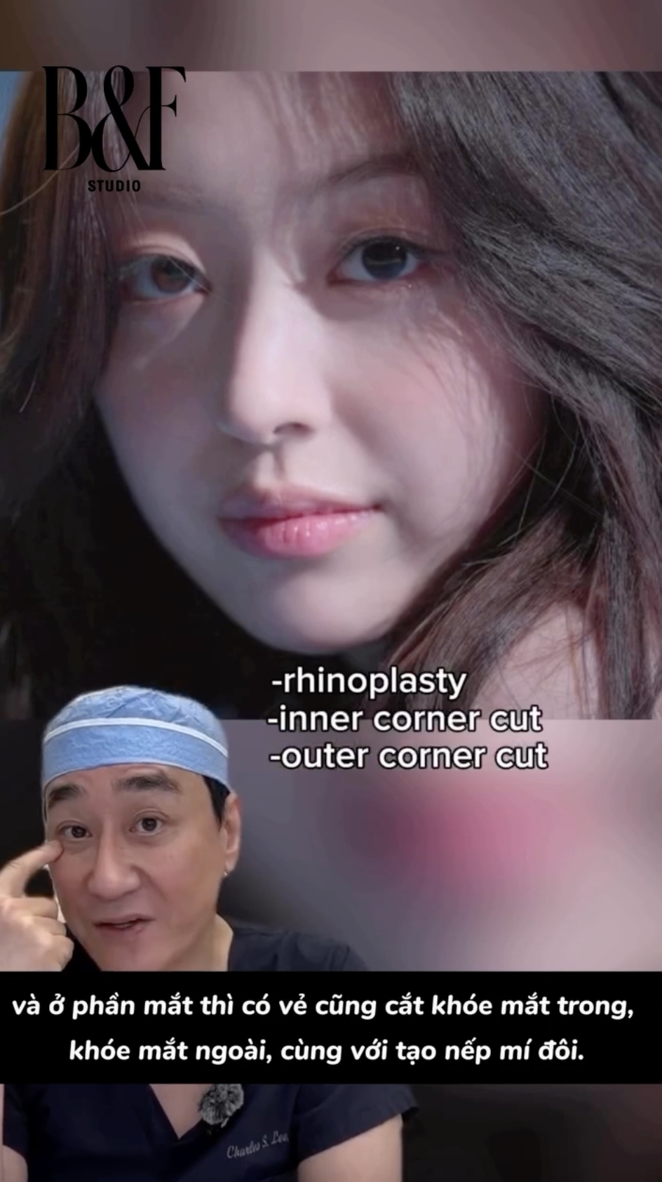 G&aacute;i xinh hot nhất show hẹn h&ograve; l&ecirc;n tiếng sau m&agrave;n phanh phui "n&aacute;t mặt" cả d&agrave;n mỹ nữ- Ảnh 6.