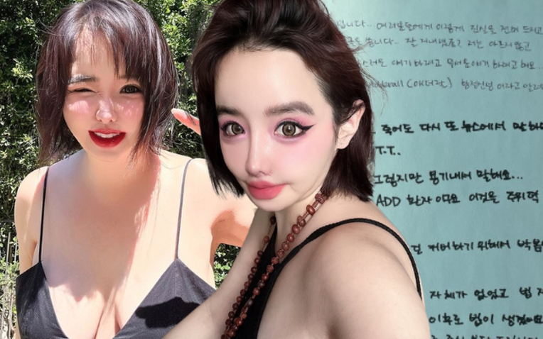 T&igrave;nh trạng đ&aacute;ng lo ngại của Park Bom sau khi viết t&acirc;m thư g&acirc;y sốc 