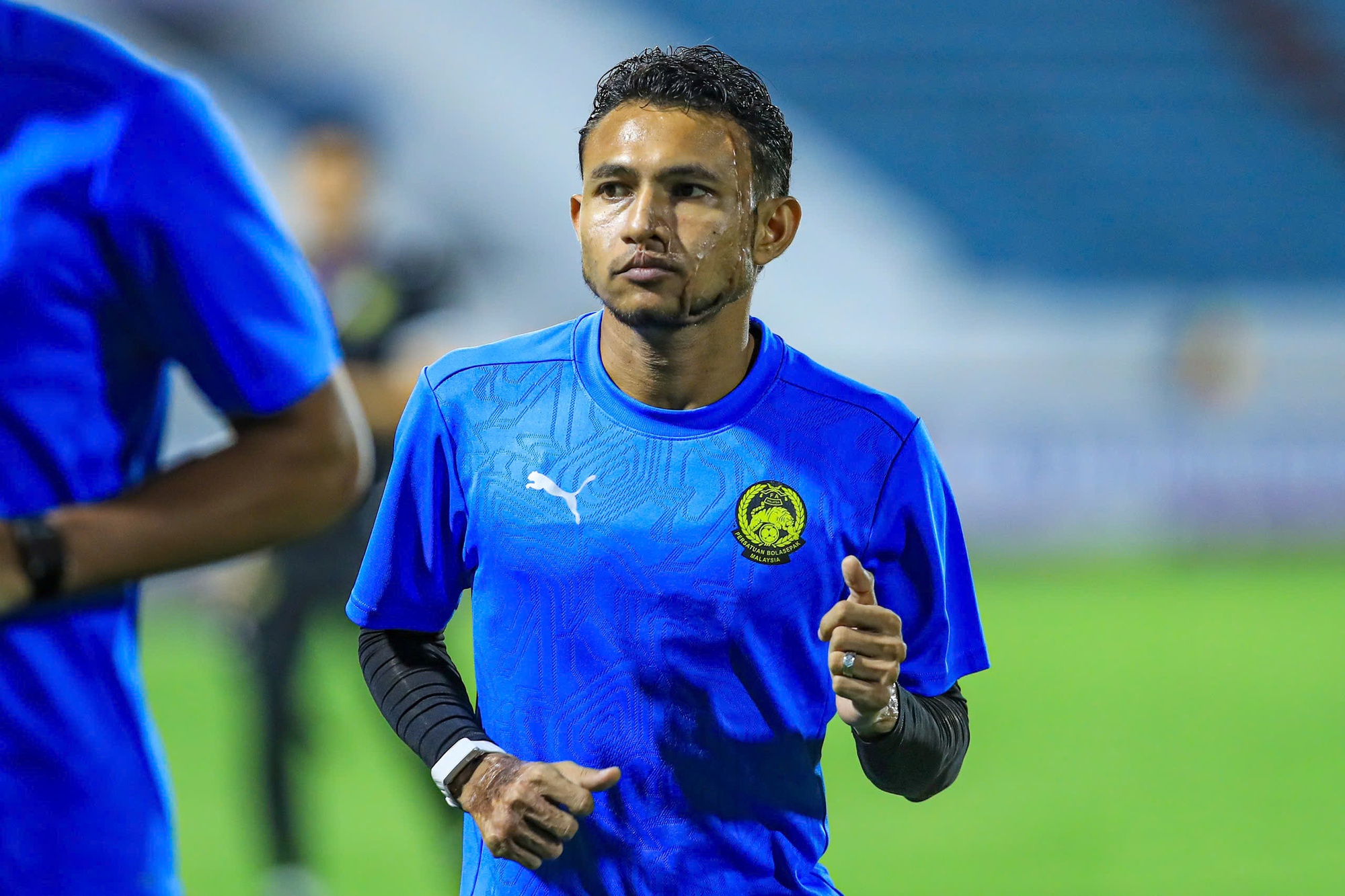 X&oacute;t xa gương mặt đầy sẹo của ng&ocirc;i sao tuyển Malaysia bị tạt axit- Ảnh 4.