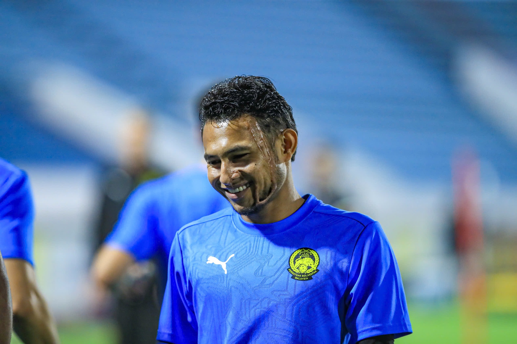 X&oacute;t xa gương mặt đầy sẹo của ng&ocirc;i sao tuyển Malaysia bị tạt axit- Ảnh 2.