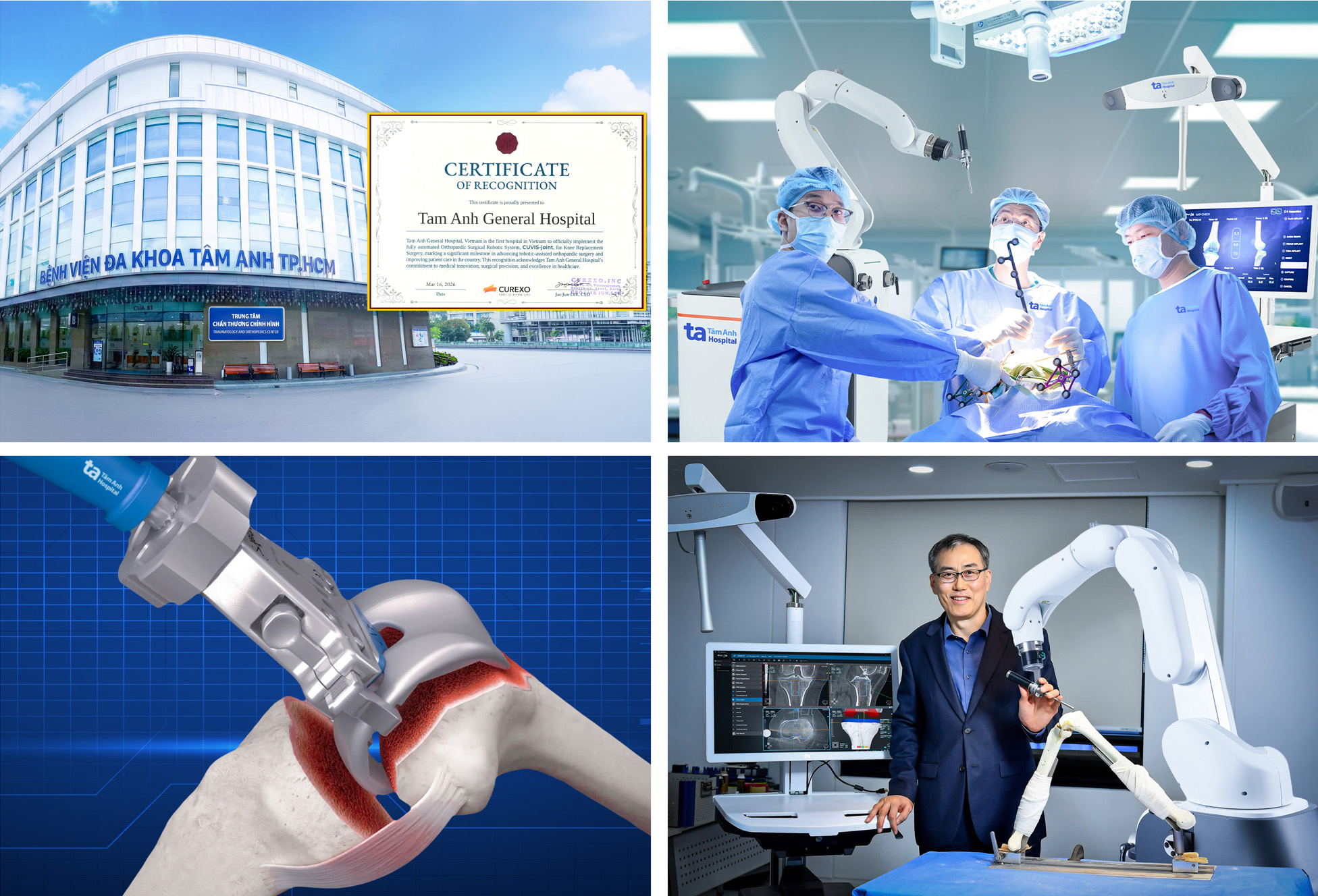 Robot AI thay khớp chuẩn x&aacute;c đến 100% đầu ti&ecirc;n tại Việt Nam- Ảnh 1.