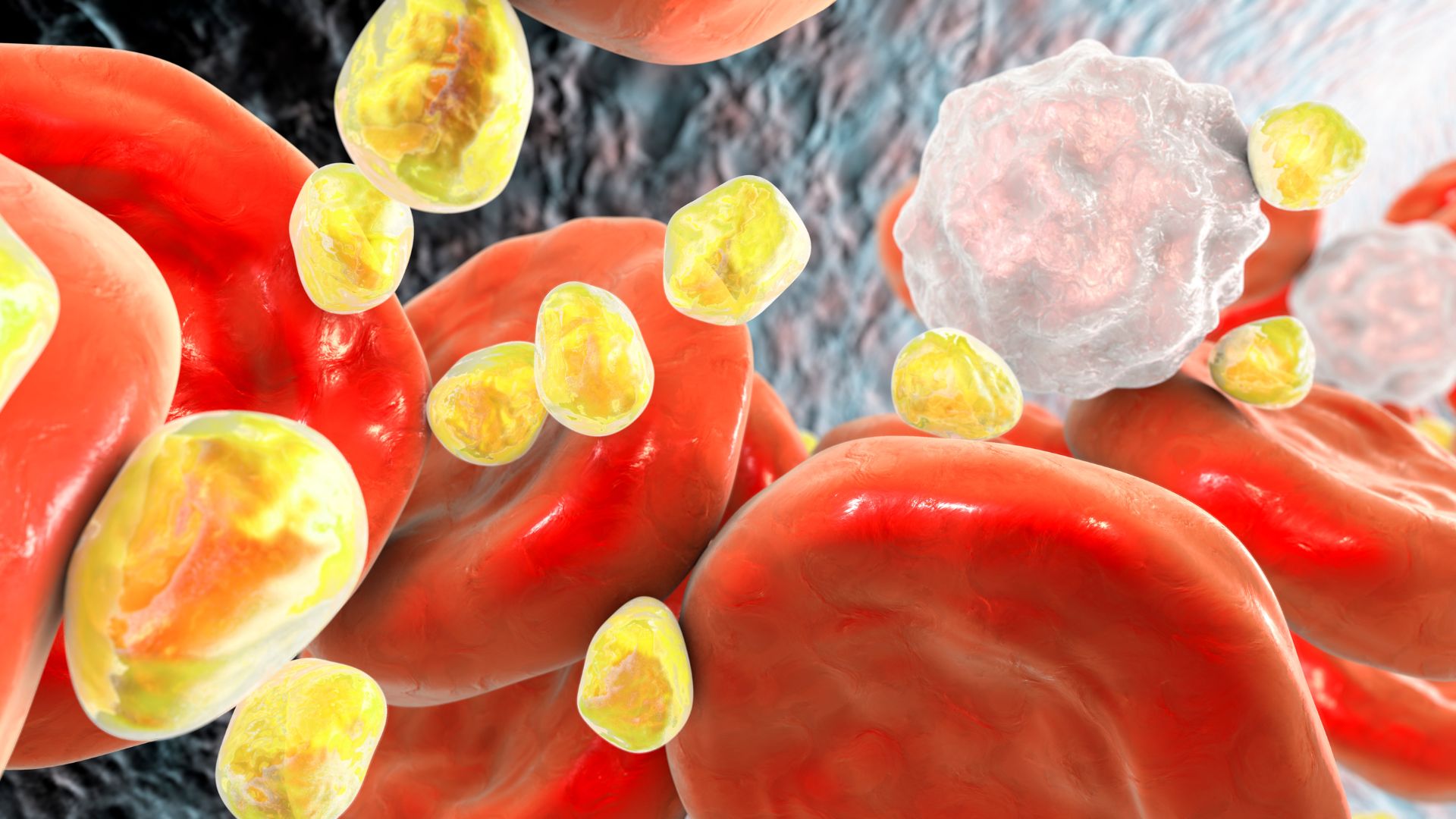 V&igrave; sao t&ocirc;i lu&ocirc;n kiểm so&aacute;t mỡ m&aacute;u nhưng khi kh&aacute;m lại vẫn kh&ocirc;ng cải thiện, thậm ch&iacute; bị nặng hơn?- Ảnh 2.